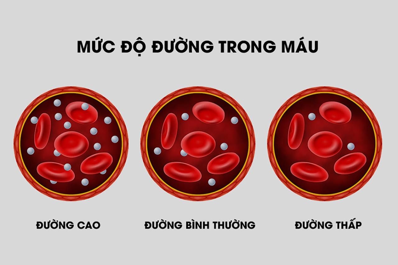 isuckhoe_dau-hieu-va-trieu-chung-tang-duong-huyet.jpg