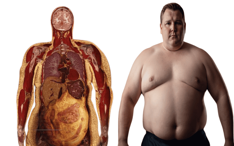 mỡ nội tạng.png